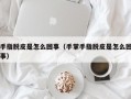 手指脱皮是怎么回事（手掌手指脱皮是怎么回事）